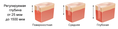 ProFractional, фракційний лазер - глибина абляції