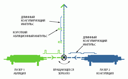 технологія TRL - лазерні шліфування